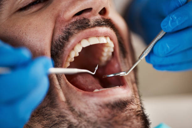 Best Cracked Tooth Emergency Dentist  in Wilburton, OK
