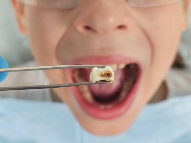 Best Dentist for Dental Trauma  in Wilburton, OK